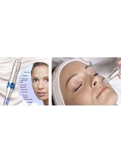 Dermaroller™ Skin needling  - Dermacare Aesthetic & Laser Institute