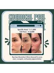 Chemical Peel - MedConsult Clinic