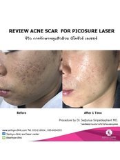 Picosure Laser. - Sarinya Clinic- Chiang Mai Thailand
