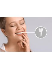 Dental Implants - Estheroyal