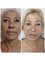 Pervin Dinçer Beauty Consultancy Nişantaşı - Skin Rejuvenation 