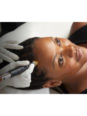 HydraFacial® Syndeo MD - New - The Wellfield Skin Clinic - Windsor