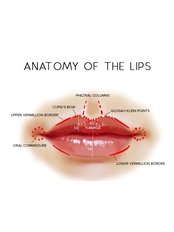 Lip Filler - Medical Aesthetics Clinic