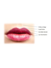 Lip Augmentation - Samantha Pierce Aesthetics