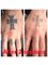 The Missing Ink: Laser Tattoo Removal - Inside Mister Barber, 227 London Road, Hazel Grove, Stockport, SK7 4HS,  0
