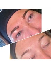 Microblading - Zest Beauty Clinic