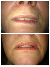Lip Liner - Bespoke Semi Permanent Make Up