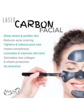 Carbon Peel Facial - Avance Clinic