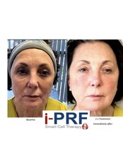 Facial & hair Rejuvenation - The Eden Clinic