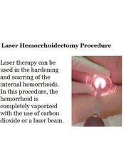 Laser Haemorrhoid Treatment - Mr Sanjaya WIjeyekoon Private General Surgeon