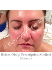 Obagi™ Skin Care - Allison Jeffery Skin Health and Laser Clinic