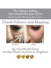 Cheek Augmentation | Was £399 - now £299 - Allison Jeffery Skin Health and Laser Clinic