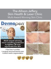 Dermapen™ - 60% Off | Add  Half Price Uber Peel £60 - Allison Jeffery Skin Health and Laser Clinic