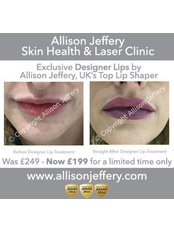 Lip Augmentation -  Designer  Lips™  - Advanced & Exclusive (1ml) Syringe) - Allison Jeffery Skin Health and Laser Clinic