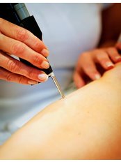 Laser Hair Removal - Wellness Clinic