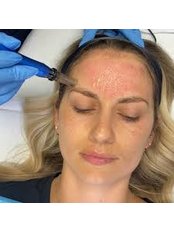 Microneedling + Collagen and LED light therapy - Kiss Kiss Aesthetics