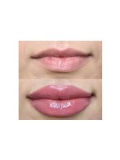 LIP BLUSH TATTOO- Semi permanent make up - Kiss Kiss Aesthetics