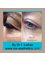 Vie Aesthetics Rayleigh - Non-surgical blepharoplasty for droopy eyelids 