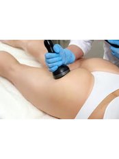 BBL - Brazilian Butt Lift - SkinGenius Medical Aesthetics
