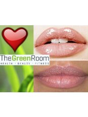 Lip Augmentation - The Green Room - Ringwood Clinic