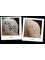 RK Exquisite - Laser Tattoo Removal 