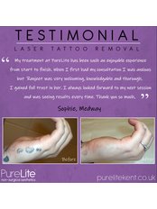 Laser Tattoo Removal - PureLite Non Surgical Aesthetics