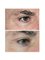 Dr. Doris Anti-Ageing Clinic - non-surgical eyelid lift and wrinkle reduction 