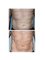 Dr. Doris Anti-Ageing Clinic - non-surgical fat reduction body sculpting 