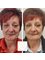 Dr Raquel Skin & Medical Cosmetics - Full face rejuvenation 
