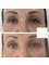 Dr Raquel Skin & Medical Cosmetics - Under eye Polynucleotides 