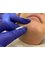 About Face Electrolysis - Permanent hair removal by electrolysis 