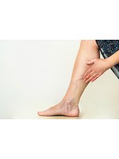 Laser thread/red vein removal - Strathearn Health and Beauty