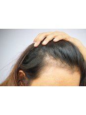 PRP Hair Care Treatment from - Strathearn Health and Beauty