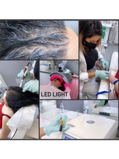 Hair loss plasma & Mieso therapy including LED light  - Dermal Aesthetic Clinic