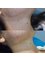 Defyne Aesthetics Skin & Laser Clinic - Laser hair removal on the neck  