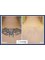 LaserLife - Laser Tattoo Removal before & After 