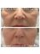 Medical and Aesthetic Clinic London - B.tox and Dermal Filler 