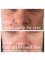 Medical and Aesthetic Clinic London - Circles under the eyes 