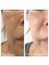 Medical and Aesthetic Clinic London - Profile Face rejuvenation 