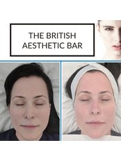 AlumierMD Medical Facial  - The British Aesthetic Bar
