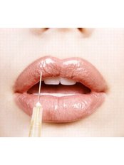 Lip Augmentation - Aestha