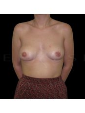 Areola Reduction - Refresh Cosmetic Surgery
