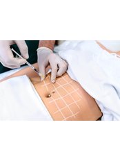 Fat Reduction Injections - Natural Enhancement Clinic