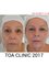 The TOA Clinic - PDO Thread lift and fillers by Sofia Maria Hayat 