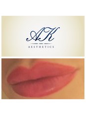 Lip Augmentation - Angela Kerr LTD
