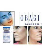 Obagi Peels - Pure Aesthetics Clinic
