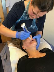 Microneedling - FaceOxford