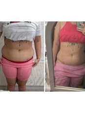 Fat Reduction Injections - Glow Aesthetics