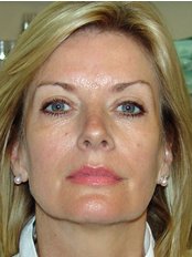 Mrs Carron Kitchen - Health Care Assistant at Stratford Dermatherapy Clinic - Chantilly