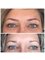 Beauty Health Aesthetics Ltd - Microblading - Semi-Permanent Make-Up Before & After 